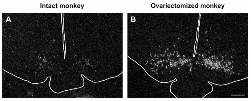 Neurokinin B m-rna expressing neurons before and after