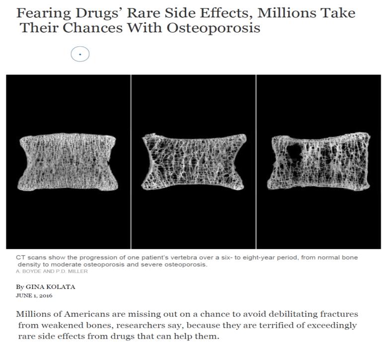 New York Times: June 1, 2016 Millions of Americans are missing out on a chance to avoid debilitating fractures from weakened bones, researchers say, because they are terrified of exceedingly rare