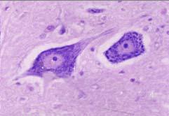 Located in the center of soma, large and pale-staining nucleus Prominent nucleolus (2)