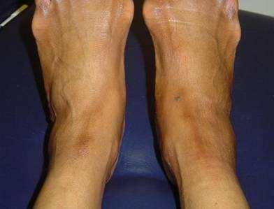 Case study 1 35 year old female Swelling of the right ankle and lower leg traumatic injury 6