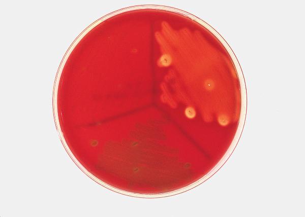 Results 5 γ β α FIGURE 1.3 Blood agar plate with three types of hemolysis. is complete lysis and destruction of the red blood cells resulting in a distinct clear zone around the colony.