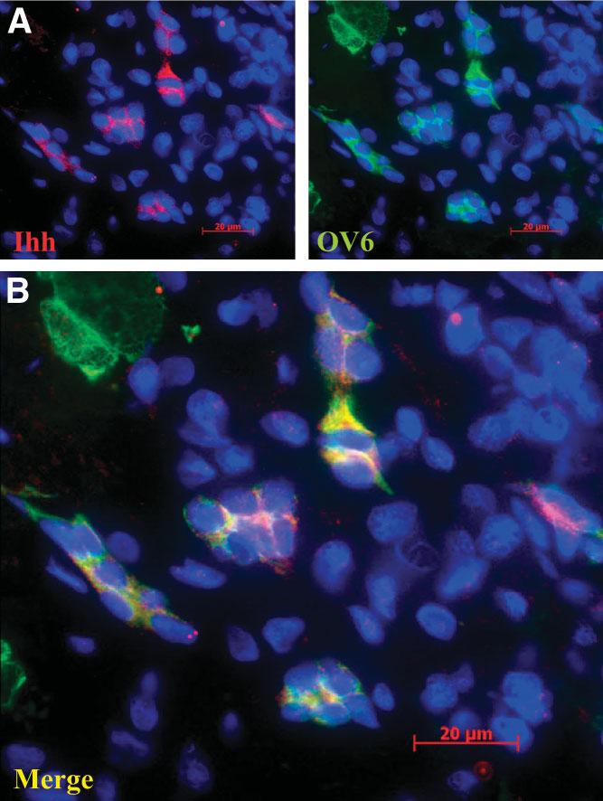 HEPATOLOGY, Vol. 45, No. 5, 2007 JUNG ET AL. 1095 Fig. 6. Ihh expression by a portion of OV6-positive cells. OV6 (Alexa Fluor 488, green) and Ihh (Alexa Fluor 568, red) are stained.