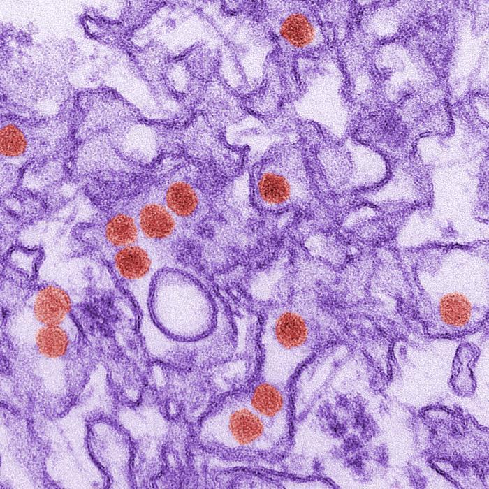 Digitally-colorized transmission electron micrograph of Zika virus. Viral particles are visible in red.