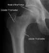 Lumbar Spine Essential Anatomy Proximal
