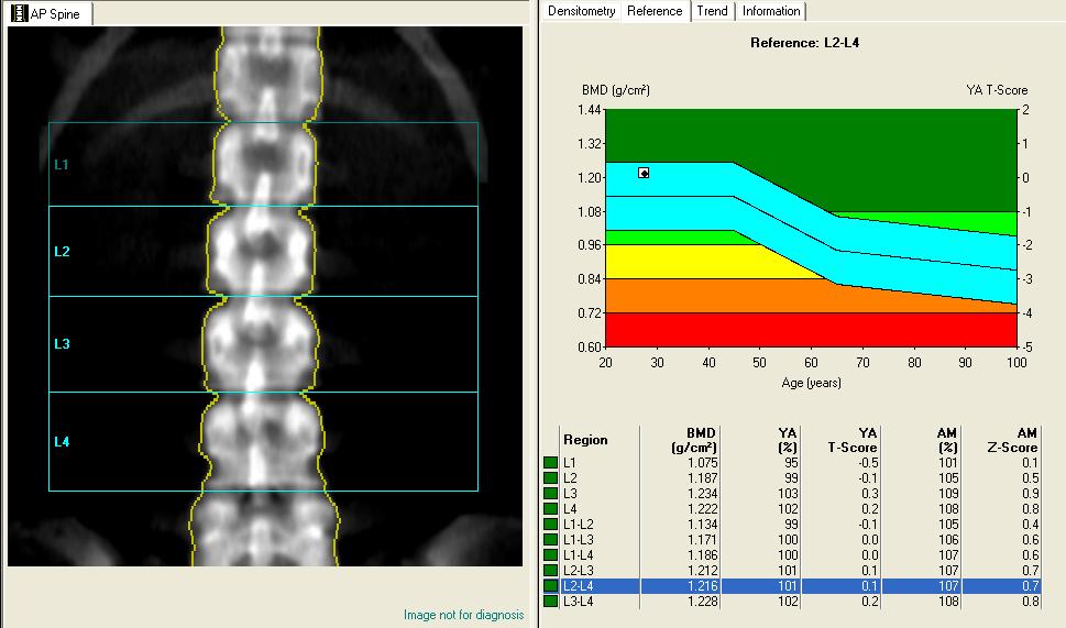 Lumbar spine anatomy with relevance to