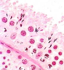 Sustentacular cell (Sertoli cell) * irregular outline of cell * nucleus with an