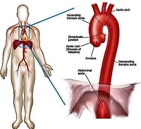 Longest and largest blood vessel Anatomical segments differ in