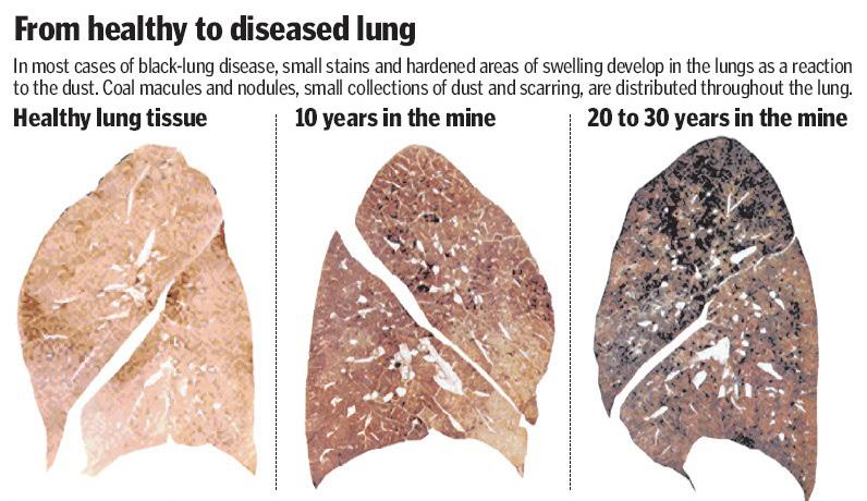 The lungs are part of a complex apparatus, expanding and relaxing thousands of times each day to bring in oxygen and expel carbon dioxide.