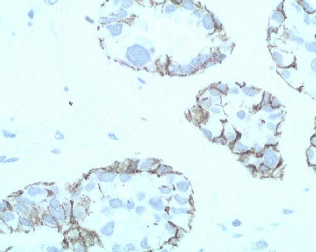 Fig. 27: Immunostain for E-cadherin is