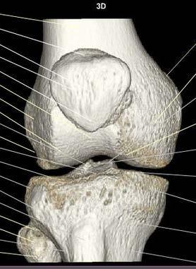 Normal Knee Bony Anatomy