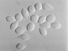 Sertoli cells