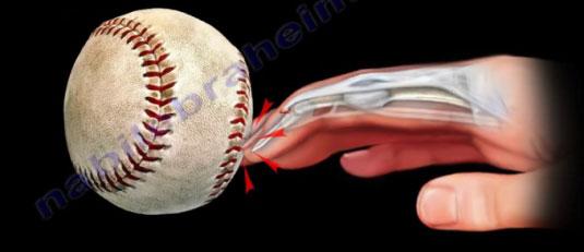 wrist injuries are a significant cause of missed days Hook of