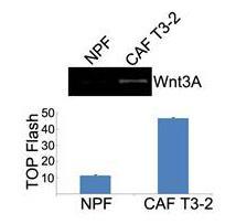 1a. To determine if active Wnt/beta-Catenin signaling induces Foxa2 and CXCR4 to promote androgen independent prostate cancer cell growth in vitro.