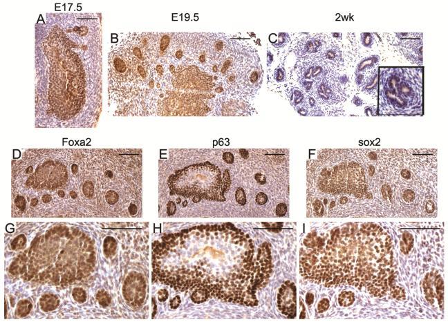 Sox2, a wnt/beta-catenin target gene, is expressed in prostate buds during embryonic development. Foxa2 and p63, two known genes expressed during prostate morphogenesis were used as positive controls.