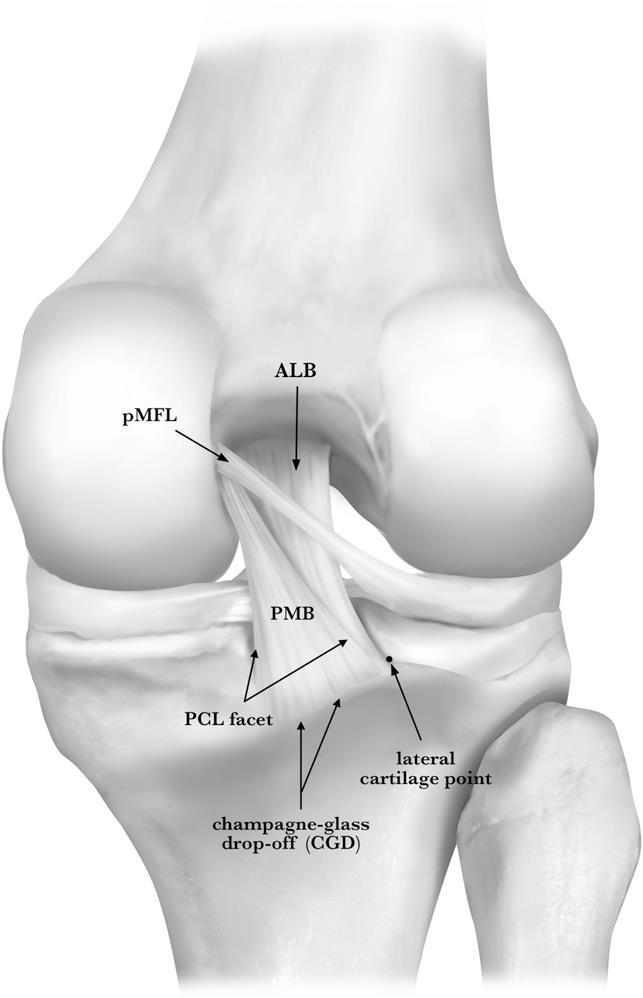 Materials Mean age 57 ACL/PCL/menisci intact Outerbridge 0/1 MFL present in all knees 6: Both Wrisberg and