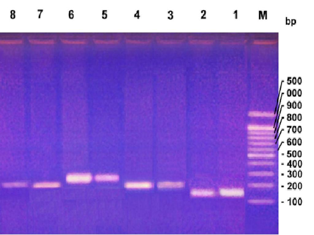 Figure 1: Frequency and types of BCR-ABL mutations in imatinib-resistant CML patients. Figure 2: ASO-PCR products on ethidium bromide-stained agarose gel for patients' no.1, 2, 3 and 4.