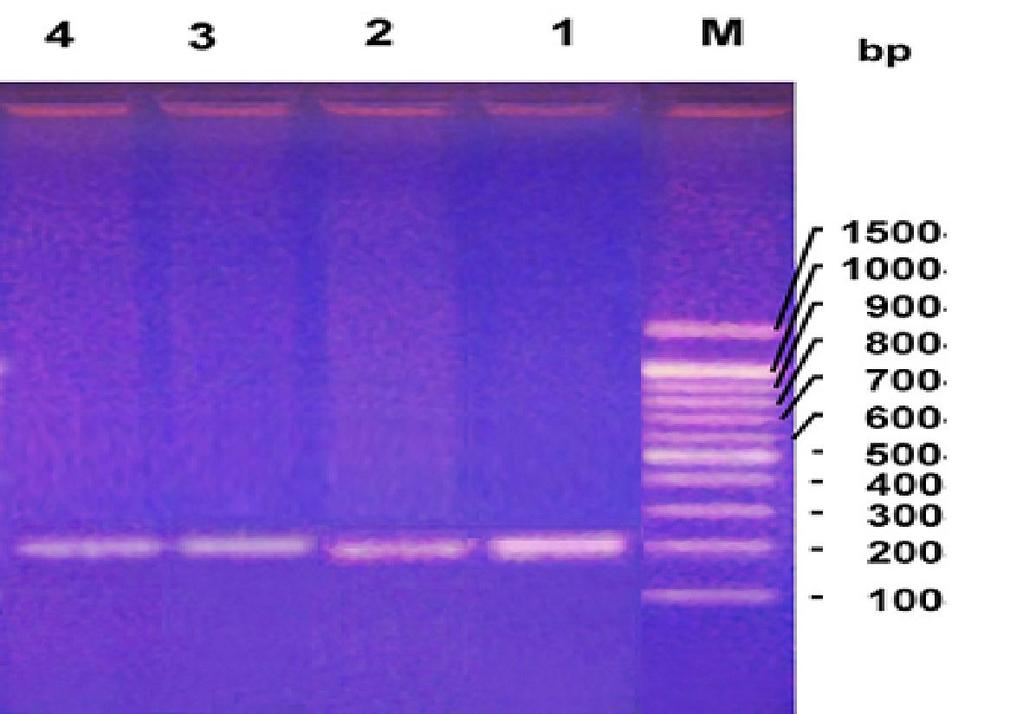 Figure 3: ASO-PCR products on ethidium bromide-stained agarose gel for patients' no.5 and 6. M: DNA marker (ladder; 100 bp). Lanes 1 & 2: DNA of patient no.
