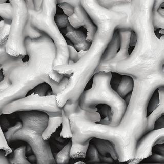 How Osteocel technology works Osteocel Cellular Allograft Osteocel is a comprehensive bone graft developed to mimic your own bone autograft.