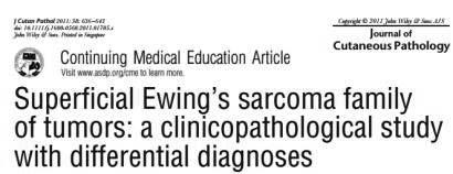 Ewing Sarcoma/Primitive Neuroectodermal Tumor (ES/PNET) Can occur at any body site