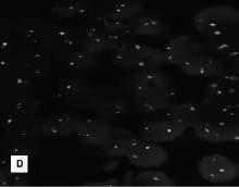Fluorescent In Situ Hybridization (FISH) for EWSR1 J Cutan Pathol 2011: 38: 636 643 CD99 ERG IHC ERG is a useful marker for confirming
