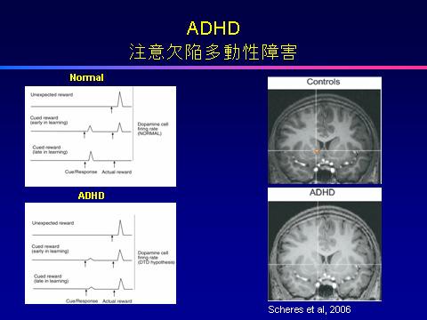 This has led to much speculation that altered brain mechanisms for reinforcement underlie many of the symptoms of ADHD.