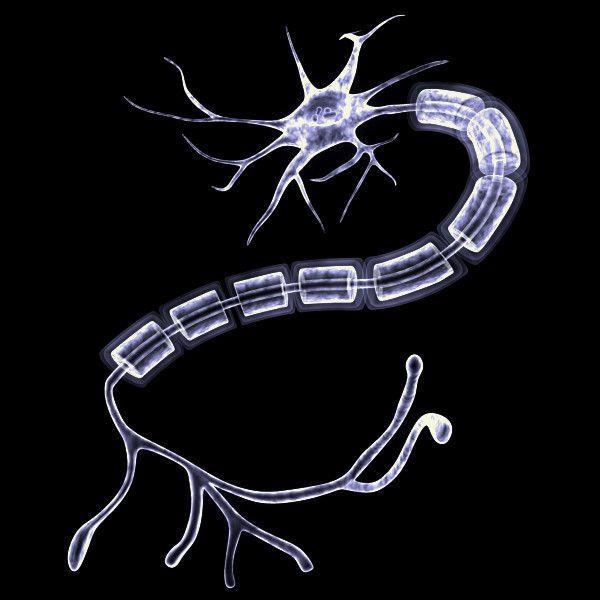 3. Axon An extension of the cell body that is