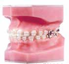 com Receive your Tooth Colored NiTi Aesthetic Wire Orthodontic Products connects orthodontists and dentists who perform