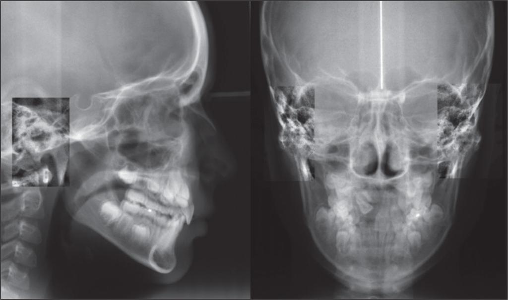 Figure 4 Initial Frontal and profile