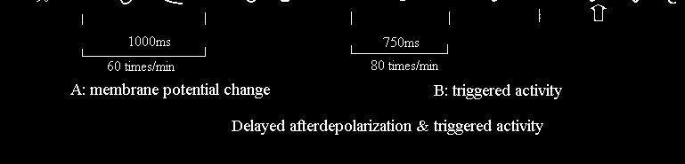 afterdepolarization (DAD) 66 phase 4 myocardial ischemia, acidosis, Ca ++, digoxin, & catecholamines 68 Causes of arrhythmia 1.