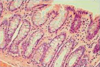 Pretretment with obesttin inhibits the development of cetic cid-induced colitis in rts Are of colonic lesions [mm 2 ] 35 30