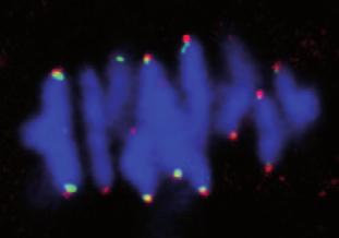 ACA DNA control ACA DNA Metaphase I Figure S3 Oocytes with