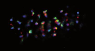 DNA ACA Transient ACA Complete Figure S5 HeLa cells were treated with MG132 and immunostained with anti-, anti- and ACA antibodies, as in Figure 5c.