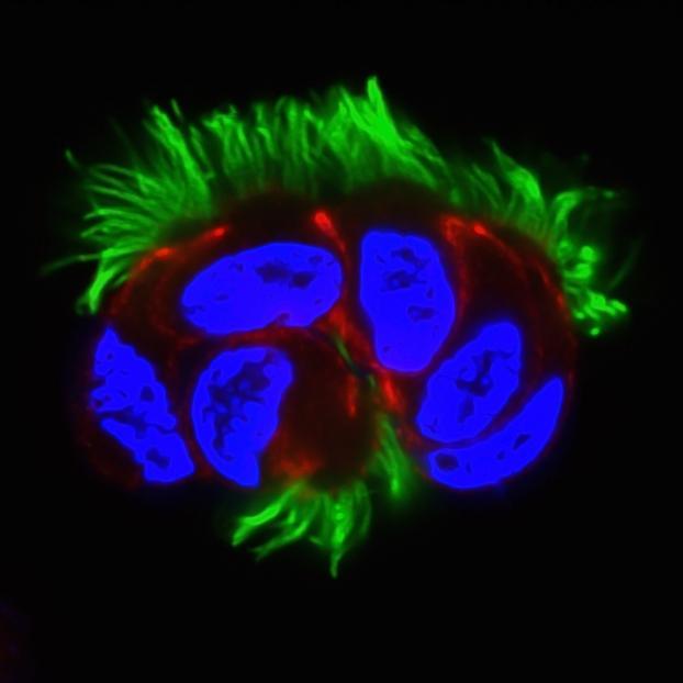 Image 1: Human airway cells produce hundreds of motile cilia. Cilia are labelled in green, cell membranes in red, and nuclei in blue.