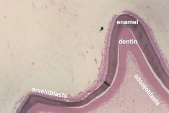View of the top of a tooth.