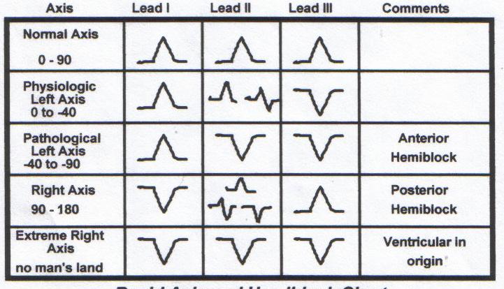 Axis Chart Look at leads I, II, and III Determine the