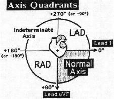 Determining Axis Axis is the direction of the impulses in the heart Helps to