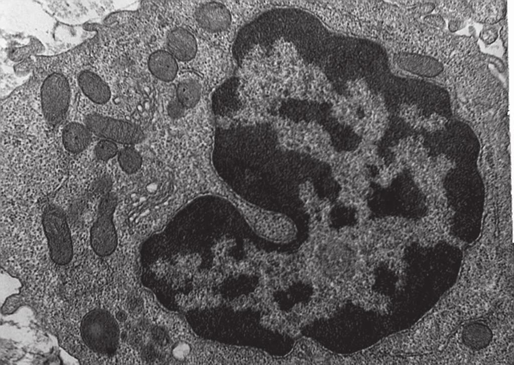 3 4 Which cell structure shown in the electronmicrograph is the site of protein modification and packaging?