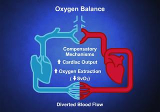 OXYGEN: BALANCE Oxygen balance is necessary to sustain life. SvO2 is the "watchdog" of this balance. When monitored, it serves as an early trouble indicator and can help clinicians adjust therapies.