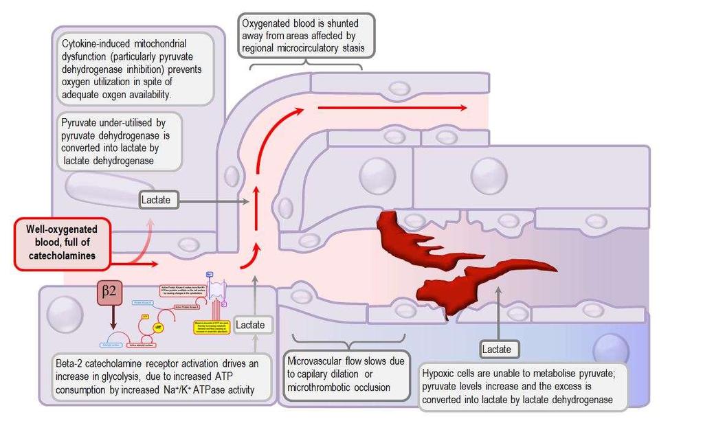 Pathophysiology of lactic