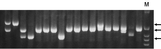 FIGURE 2. Gel electrophoregram showing results of PCR amplification of the DRD4 exon III VNTR from genomic DNA obtained from buccal cells from test subjects.