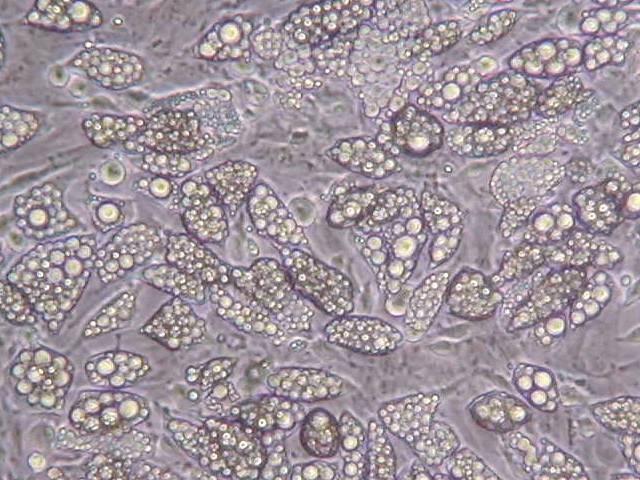 Adipocytes Mesenteric Epididymal Subcutaneous Mesenteric adipocytes (Day 9) Epididymal adipocytes (Day 9) Subcutaneous adipocytes (Day 9)