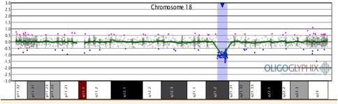 Characterization of Chromosome 18q21.