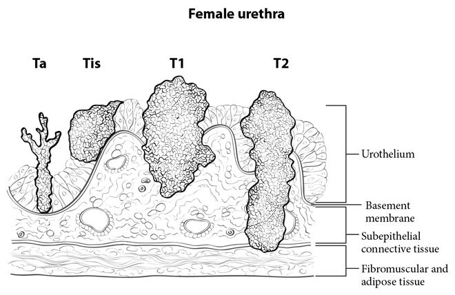 63.2. Male Penile and Female Urethra:
