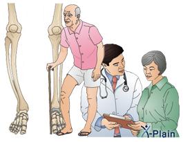 Knee pain An uncommon cause Dr.