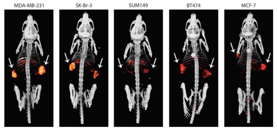 Imaging of tumor PD-L1 expression using radiolabeled anti-pd-l1