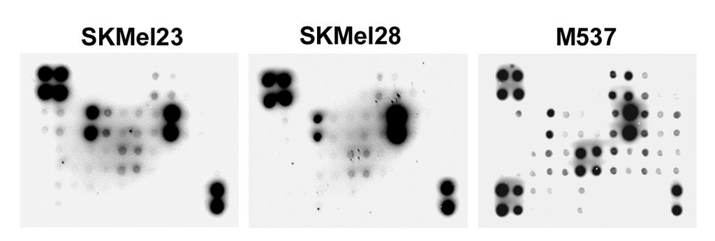 A subset of melanoma cell lines expresses a broad array of chemokines Gro-α SKMel23 M888 M537 1 2 1 2 IL-8 10 11 7 8 9 3 4 5 6 CCL2 CCL4 CCL5