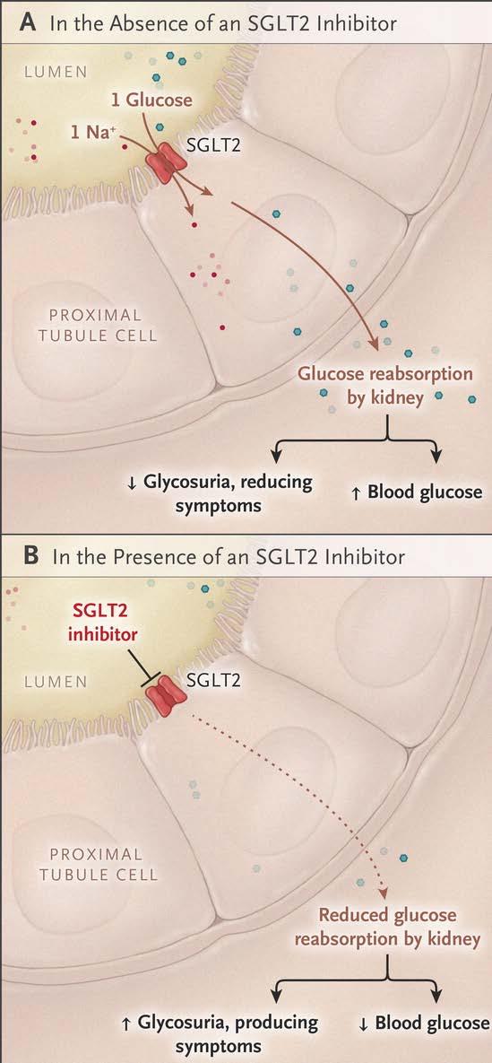 SGLT2 Inhibitors Canagliflozin Invokana Empagliflozin Jardiance