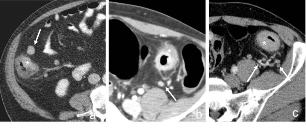 7: Axial CT images after IV contrast administration (portal venous phase).