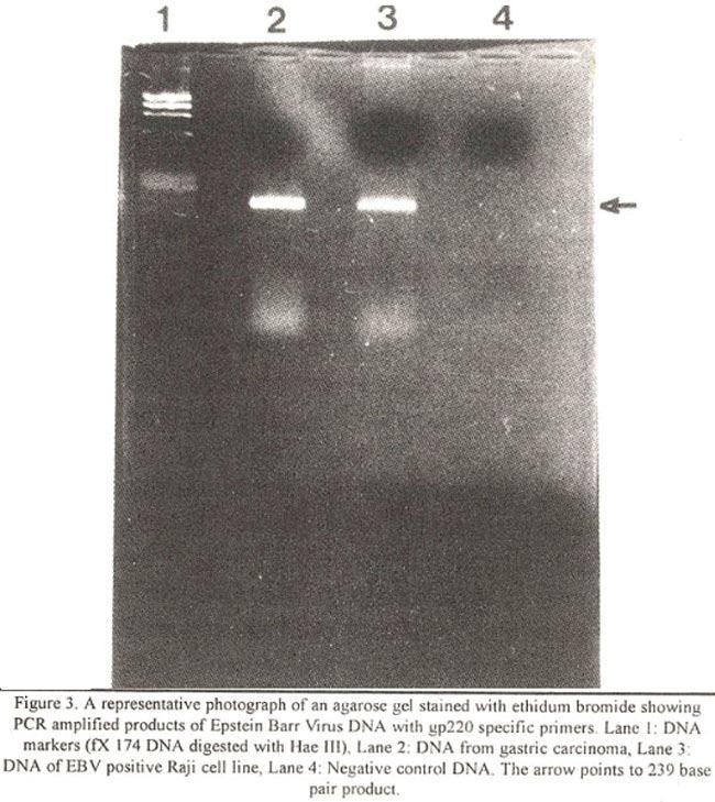 The PCR was- performechin a Perkin Elmer 9600 thermocyler. DNA was added to the PCR mixture which contained, reaction buffer (10mM Tris ph 7.4, 50mM KC1 and 1.5 mm MgCI), 200 mm each of dntps, 0.