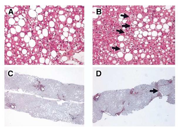Sampling variability in liver biopsy of patients